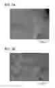 Fig. 02 - SELECTION OF PLATELET RICH PLASMA COMPONENTS VIA MINERAL BINDING