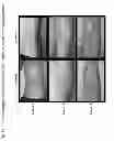 Fig. 35 - METHOD AND COMPOSITION FOR IMPROVING SKIN CONDITIONS COMPRISING HUMAN PLACENTAL LACTOGEN AS AN ACTIVE INGREDIENT