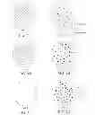 Fig. 02 - Particulate tissue graft with components of differing density and methods of making and using the same