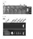 Fig. 09 - Hypoxia-responsive nanoparticle for therapy and imaging of hypoxia-involving diseases