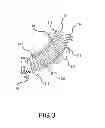 Fig. 04 - Nanoparticles, Compositions Thereof, and Methods of Use, and Methods of Making the Same