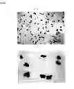 Fig. 04 - Fexofenadine microcapsules and compositions containing them