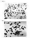 Fig. 07 - Fexofenadine microcapsules and compositions containing them