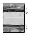 Fig. 11 - Compositions for enhancing wound healing containing magnesium and bromide