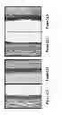 Fig. 12 - Compositions for enhancing wound healing containing magnesium and bromide