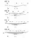 Fig. 05 - Method of repairing composite material and composite material