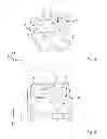 Fig. 04 - Injection mold and injection-molded part