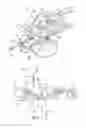 Fig. 02 - METHOD OF USING A SPRAY GUN AND MATERIAL PRODUCED THEREBY