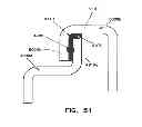Fig. 35 - Construction of electrochemical storage cell with conductive bridge