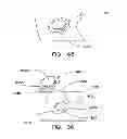 Fig. 44 - Construction of electrochemical storage cell with conductive bridge