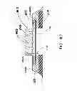 Fig. 45 - Construction of electrochemical storage cell with conductive block