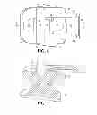 Fig. 04 - Self-ligating bracket with sliding cover