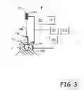 Fig. 04 - INTEGRATIVE SYSTEM FOR DENTAL PROCEDURES