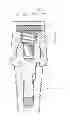 Fig. 01 - Keeper for implant and its assembly, and keeper-fixing method