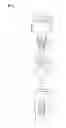 Fig. 02 - Keeper for implant and its assembly, and keeper-fixing method