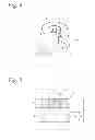 Fig. 04 - Keeper for implant and its assembly, and keeper-fixing method