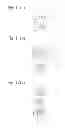 Fig. 08 - Keeper for implant and its assembly, and keeper-fixing method