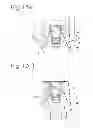Fig. 10 - Keeper for implant and its assembly, and keeper-fixing method