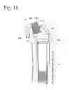 Fig. 14 - Keeper for implant and its assembly, and keeper-fixing method