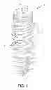 Fig. 02 - Dental implant and method of implantation