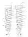 Fig. 03 - Dental implant and method of implantation