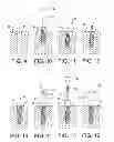 Fig. 07 - Dental implant and method of implantation