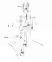 Fig. 12 - Interventive-diagnostic device