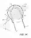 Fig. 15 - Medical device and procedure simulation and training