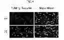 Fig. 06 - Nucleic acid encoding a self-assembling split-fluorescent protein system