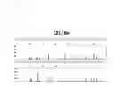 Fig. 04 - Fast PCR for STR Genotyping