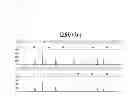 Fig. 05 - Fast PCR for STR Genotyping