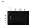Fig. 09 - DETECTION KIT CONTAINING A NOVEL RECOMBINANT 15-kDA POLYPEPTIDE USEFUL FOR DETECTING HUMAN INFECTION WITH BARTONELLA HENSELAE