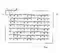 Fig. 06 - Microfluid device and method of producing diffusively built gradients