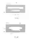 Fig. 04 - Nucleic acid amplification using microfluidic devices