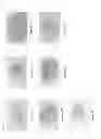 Fig. 02 - Stem cell separating material and method of separation