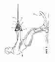 Fig. 02 - Protective bridle for waterskiing