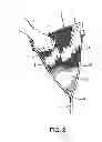 Fig. 03 - Protective bridle for waterskiing