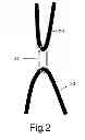 Fig. 03 - Water craft leash