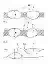 Fig. 03 - Electroconductive tape