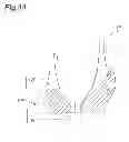 Fig. 14 - GARMENT WITH CUP PART