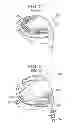 Fig. 04 - Automatic club setting and ball flight optimization
