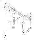Fig. 11 - Automatic club setting and ball flight optimization