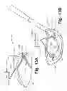 Fig. 13 - Automatic club setting and ball flight optimization