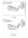 Fig. 17 - Iron-type golf club