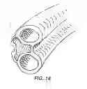 Fig. 16 - Methods and apparatuses for enhancing performance in racket sports