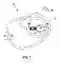 Fig. 02 - Strength training aid