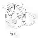Fig. 06 - Strength training aid