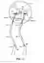 Fig. 08 - Exercise device using undulation members