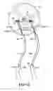 Fig. 09 - Exercise device using undulation members