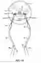 Fig. 10 - Exercise device using undulation members